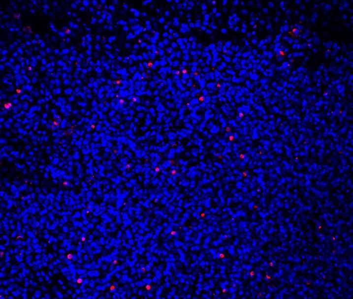 Apoptosis Activator 2 2098