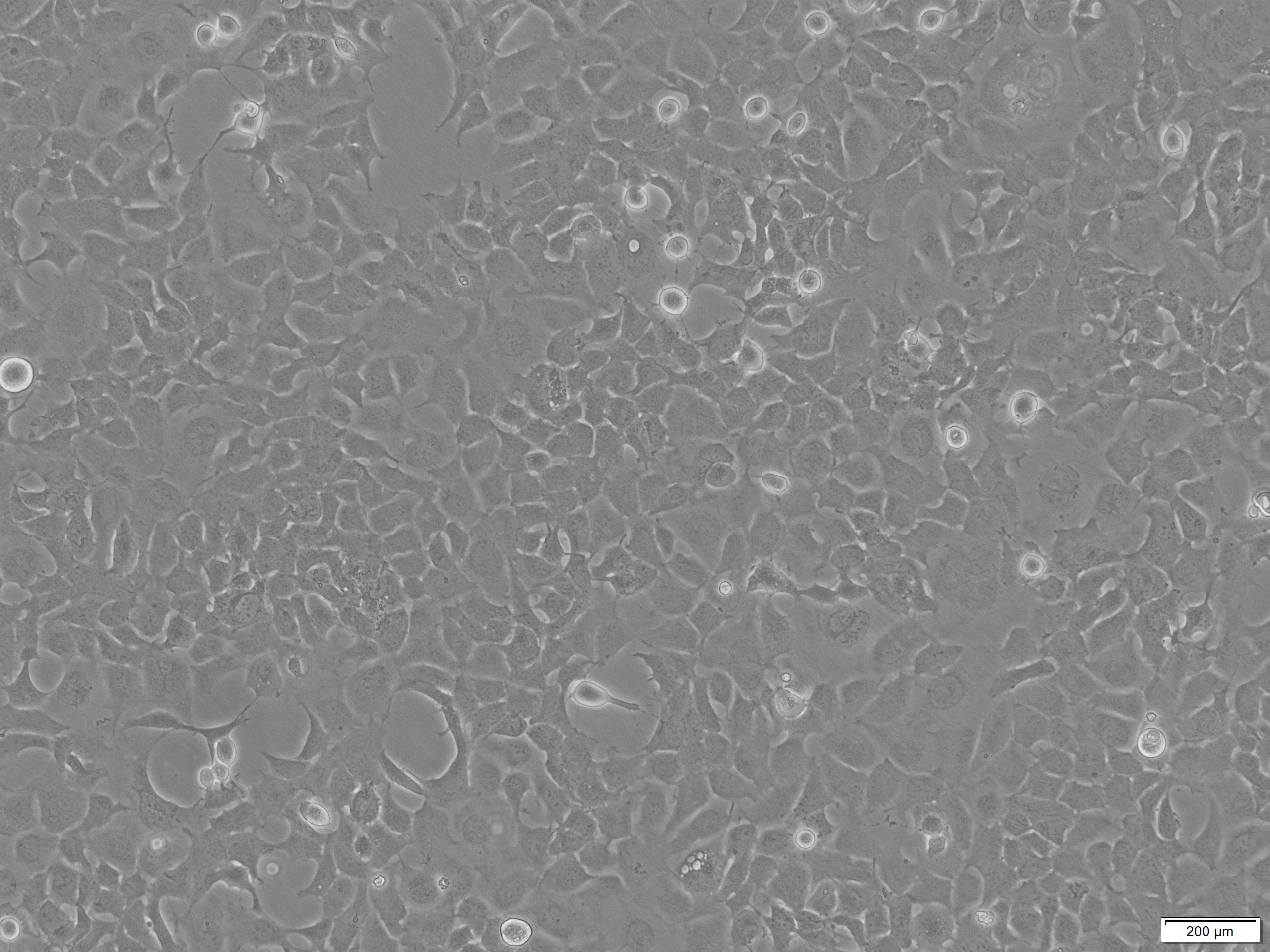 Recombinant Human TNF-alpha Protein 210-TA