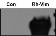 Recombinant Human Vimentin Protein, CF 2105-VI