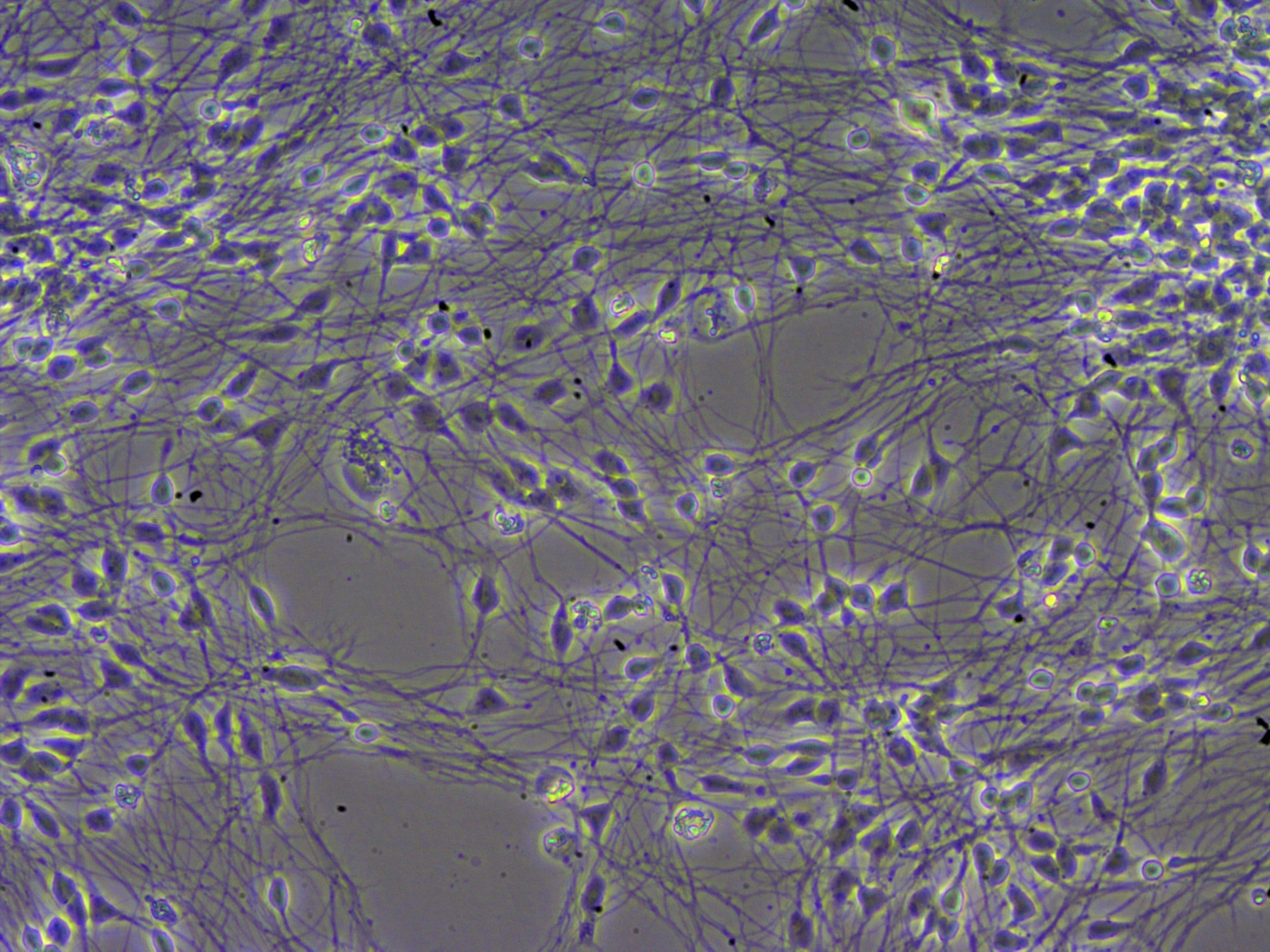 Recombinant Human GDNF Protein 212-GD
