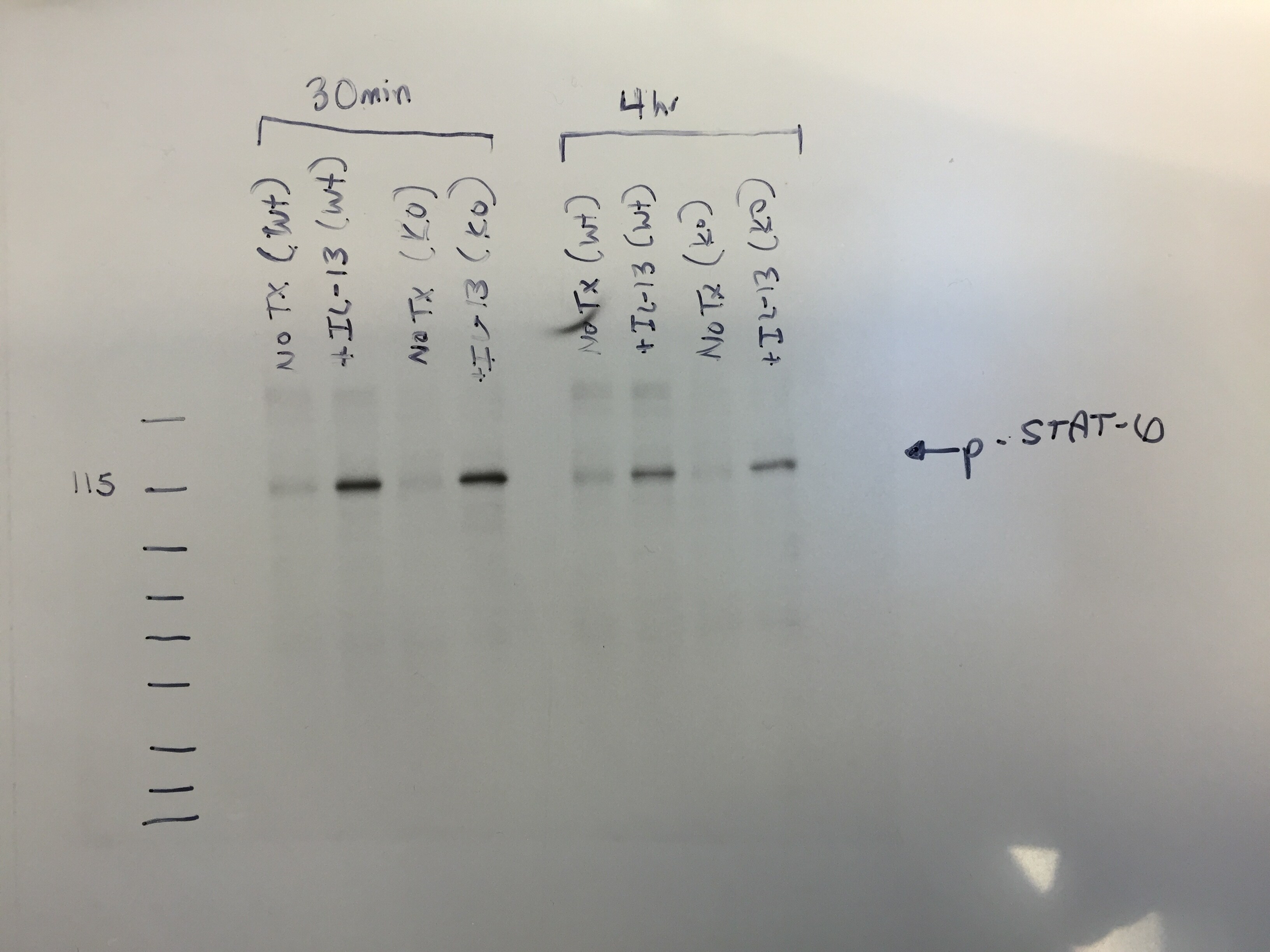 Recombinant Human IL-13 Protein 213-ILB