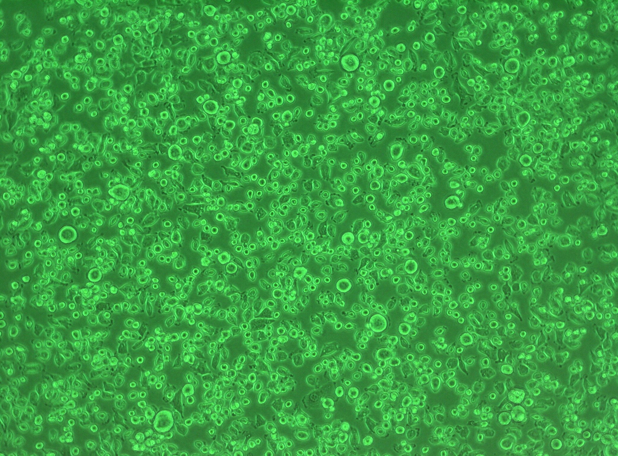 Recombinant Human GM-CSF Protein 215-GM