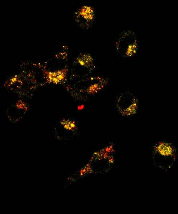 Recombinant Human GM-CSF Protein 215-GM