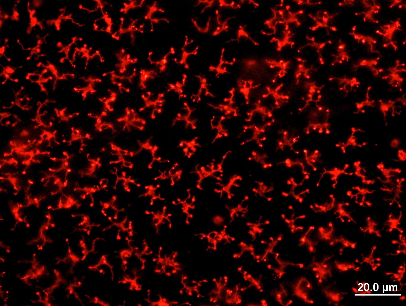 Recombinant Human GM-CSF Protein 215-GM