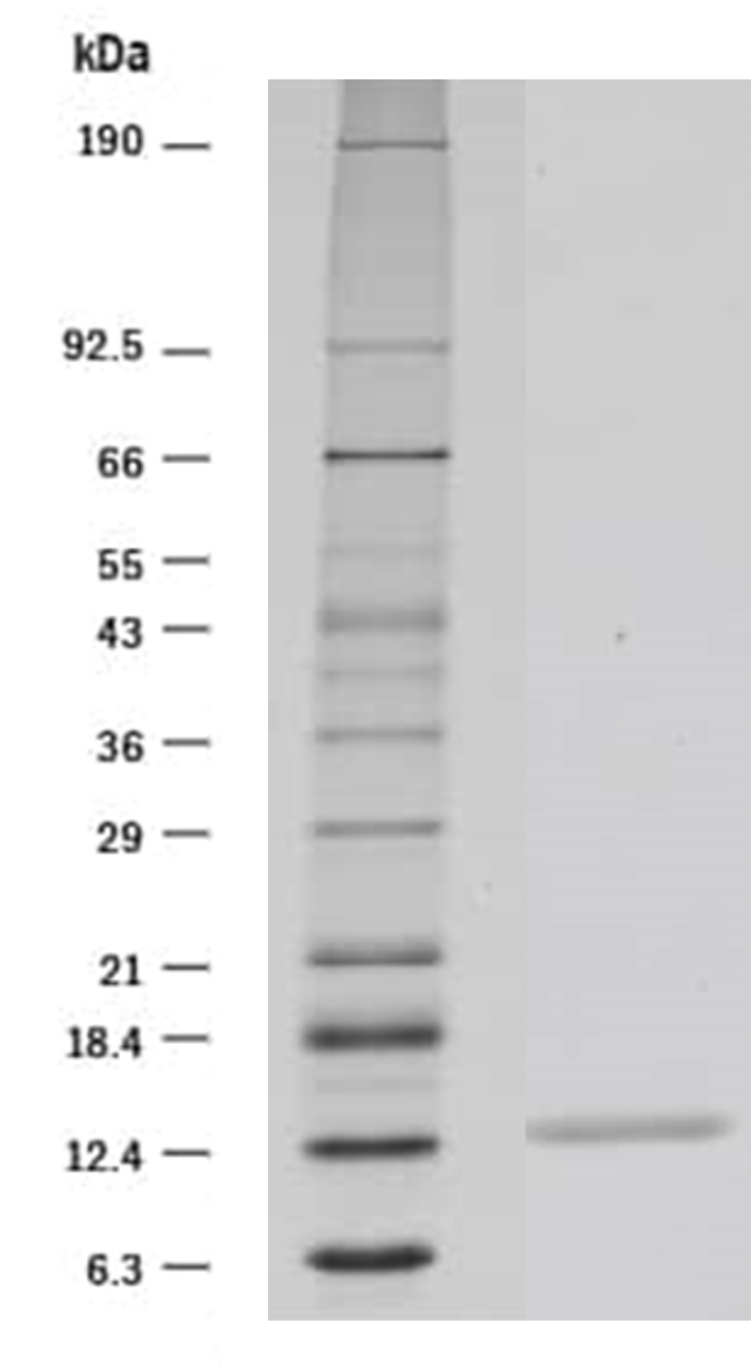 Recombinant Human GM-CSF Protein 215-GM
