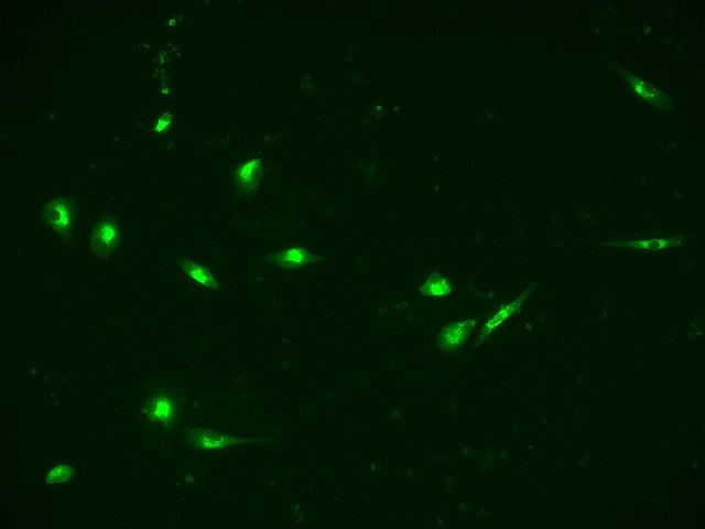 Recombinant Human GM-CSF Protein 215-GM