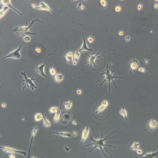 Recombinant Human GM-CSF Protein 215-GM