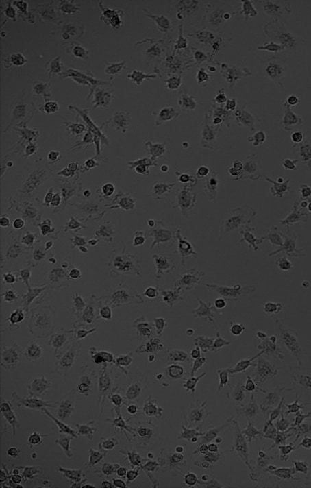 Recombinant Human M-CSF Protein 216-MC