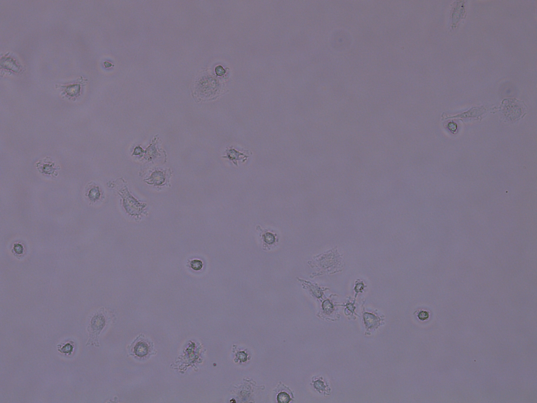 Recombinant Human M-CSF Protein 216-MC