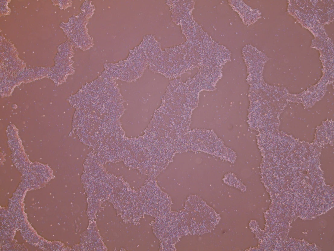 Recombinant Human M-CSF Protein 216-MC