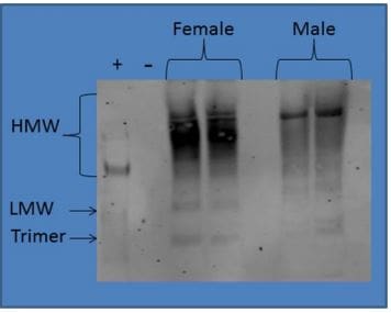 Recombinant Human PDGF-BB Protein, CF 220-BB
