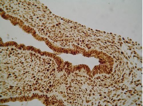 Recombinant Human PDGF-BB Protein, CF 220-BB