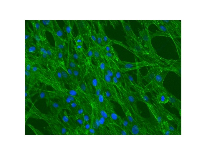 Recombinant Human PDGF-BB Protein, CF 220-BB