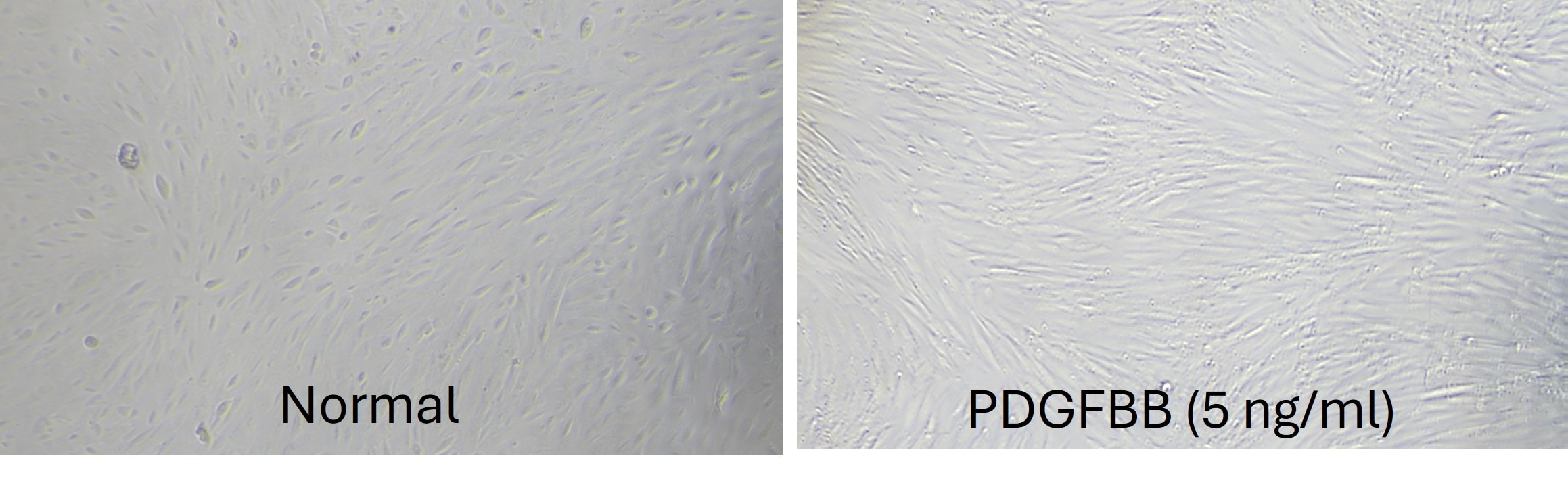 Recombinant Human PDGF-BB Protein, CF 220-BB