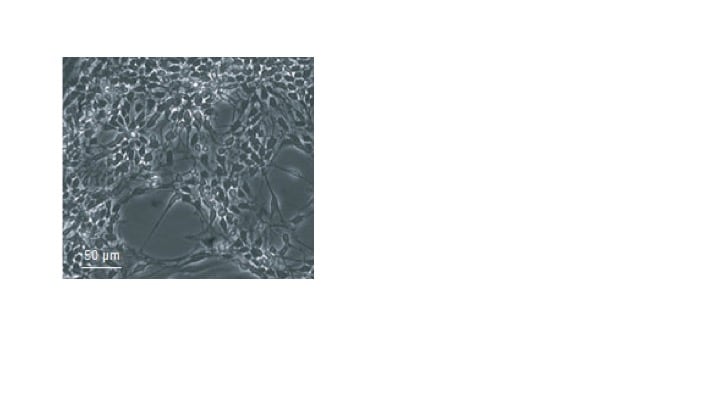 Recombinant Human PDGF-AA Protein, CF 221-AA