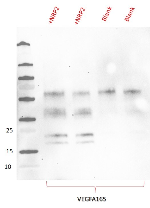 Recombinant Human Neuropilin-2 Fc Chimera Protein, CF 2215-N2