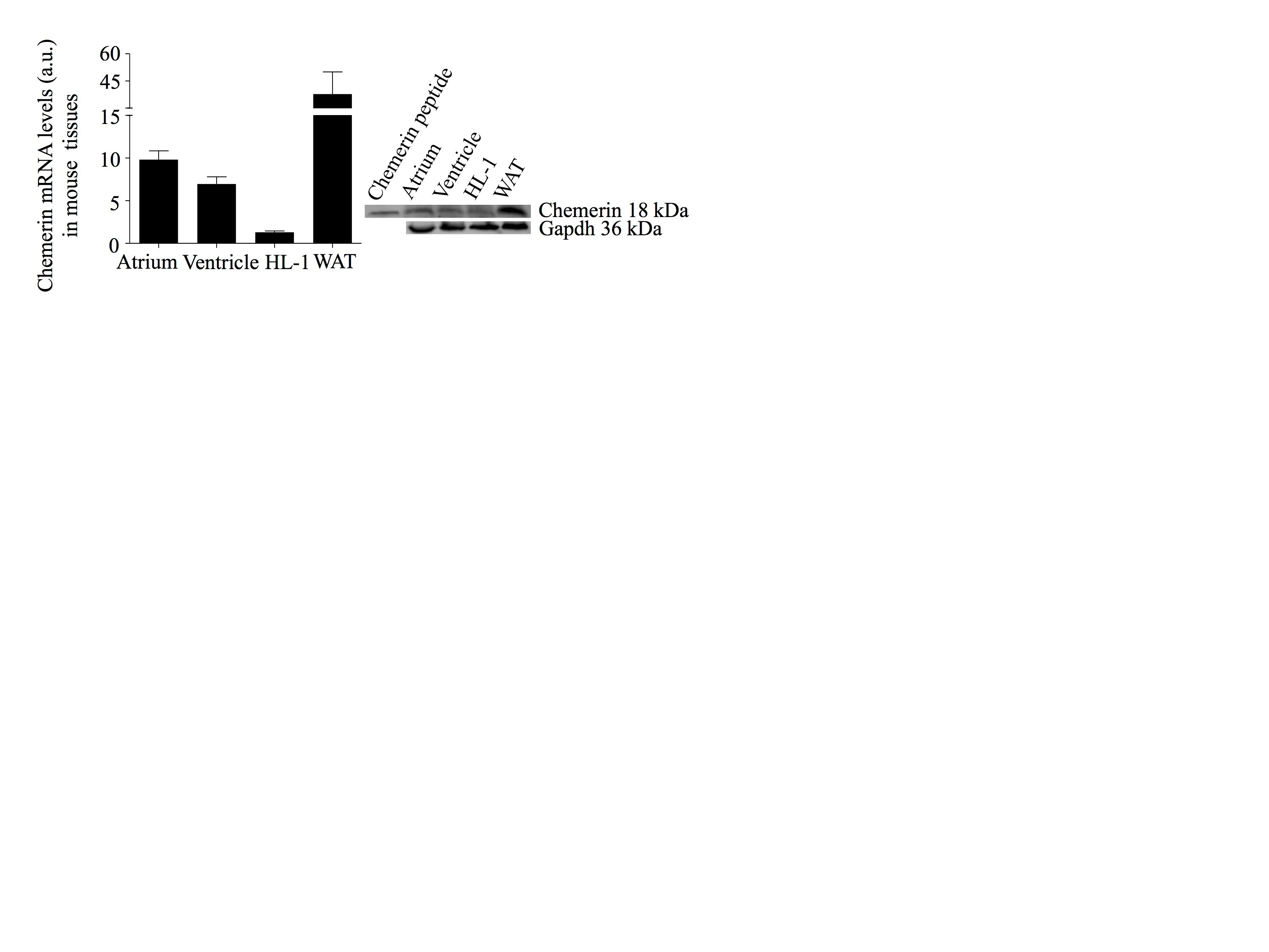 Recombinant Mouse Chemerin (aa 17-156) Protein 2325-CM
