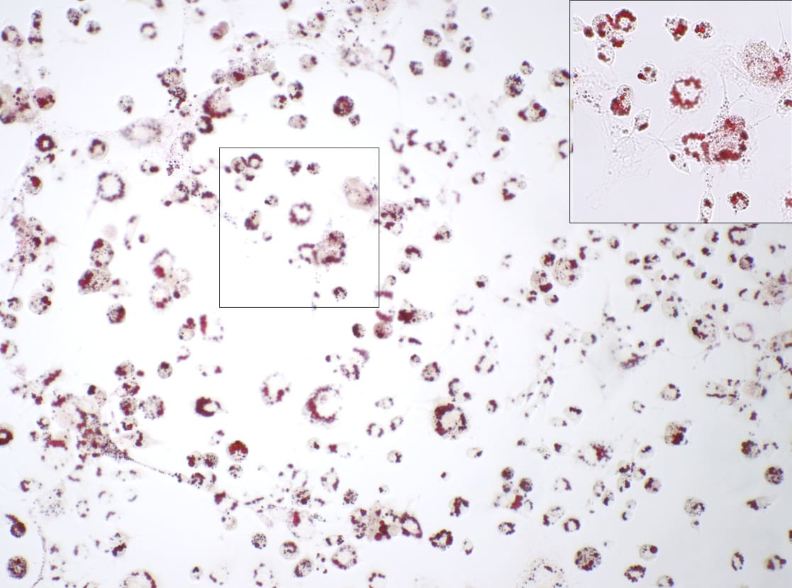 Recombinant Human EGF Protein, CF 236-EG