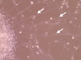 Recombinant Human EGF Protein, CF 236-EG