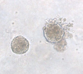 Recombinant Human EGF GMP Protein, CF 236-GMP