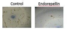 Recombinant Human Endorepellin Protein, CF 2364-ER