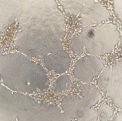 Recombinant Mouse Pentraxin 2/SAP His-tag Protein, CF 2558-SAB