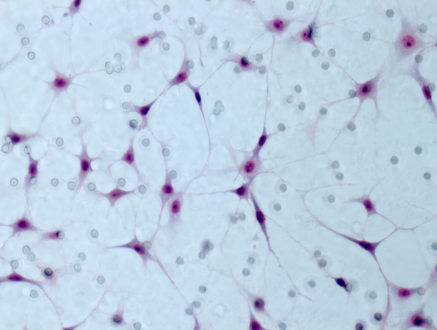 Recombinant Human beta-NGF Protein 256-GF