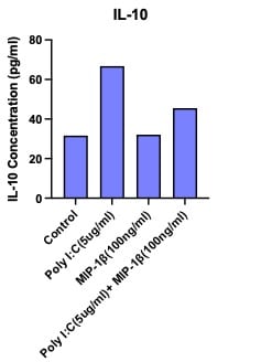 Recombinant Human CCL4/MIP-1 beta Protein 271-BME