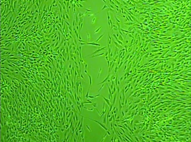 Recombinant Human CCL2/MCP-1 Protein 279-MC