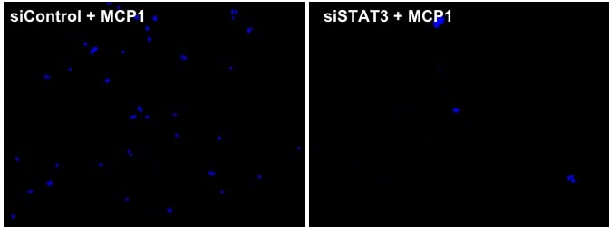 Recombinant Human CCL2/MCP-1 Protein 279-MC