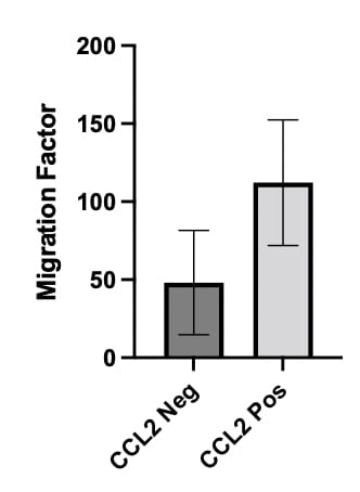 Recombinant Human CCL2/MCP-1 Protein 279-MC