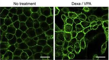 Valproic acid, sodium salt 2815