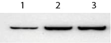 Recombinant Human IFN-gamma Protein 285-IF