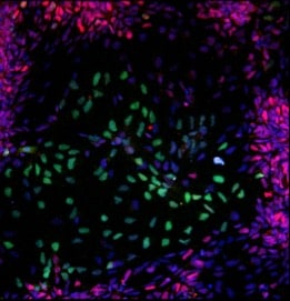 Recombinant Human IGF-I/IGF-1 Protein, CF 291-G1