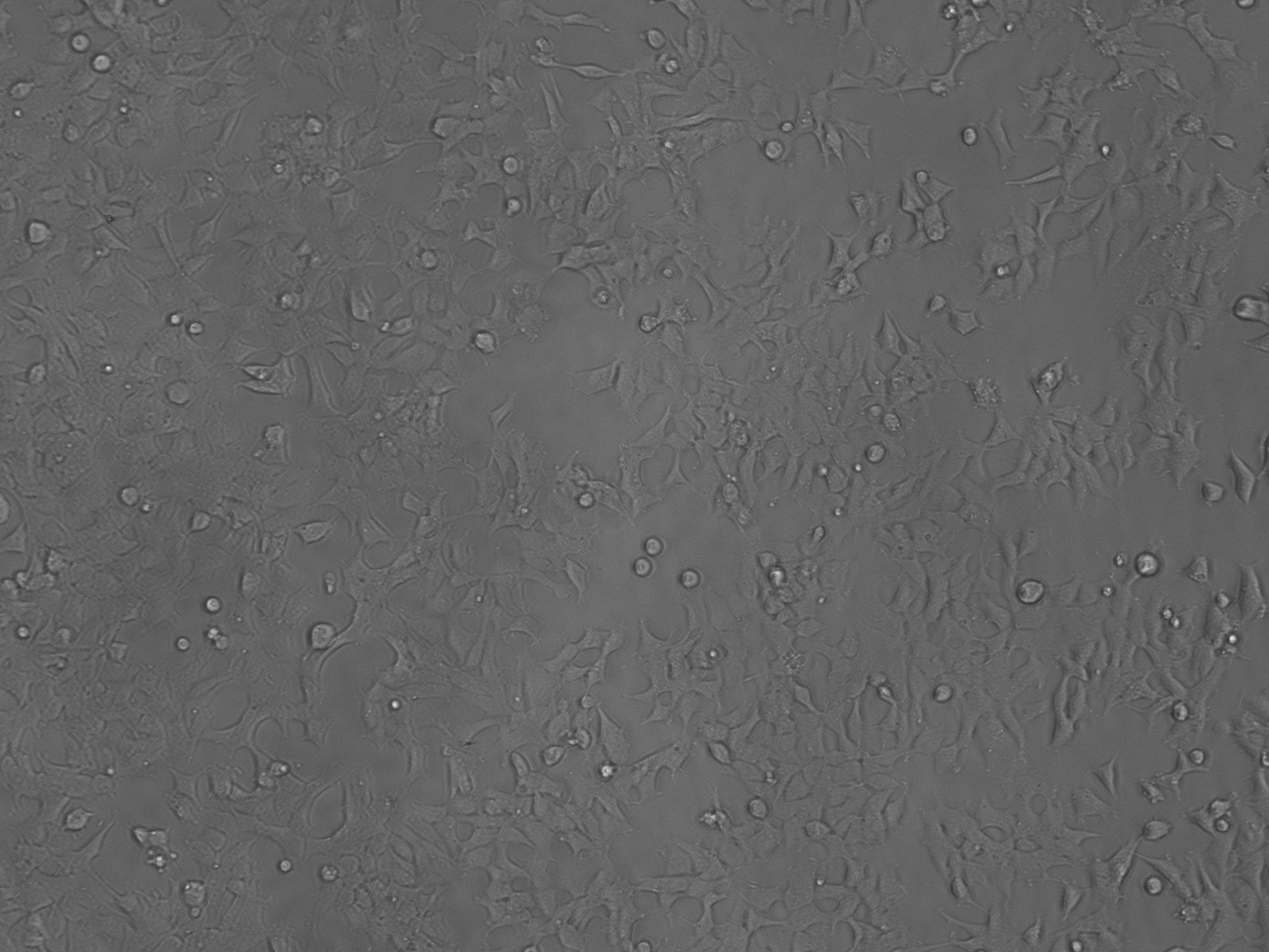 Human Holo-Transferrin Protein, CF 2914-HT