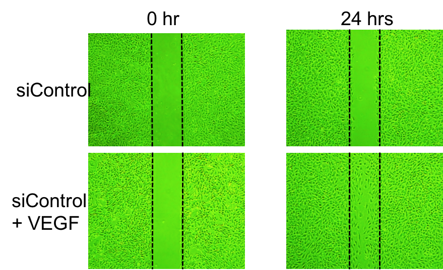 Recombinant Human VEGF 165 Protein 293-VE