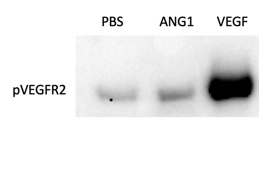 Recombinant Human VEGF 165 Protein 293-VE