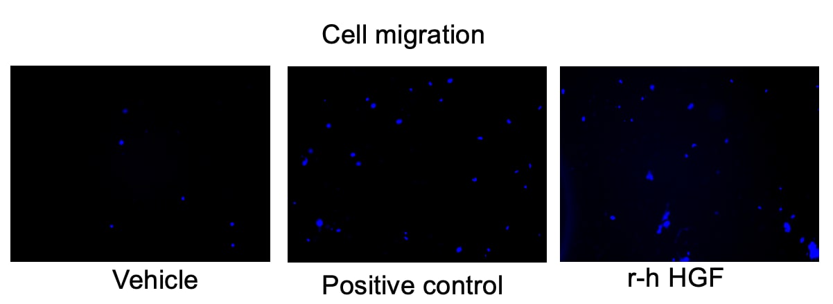 Recombinant Human HGF Protein 294-HG