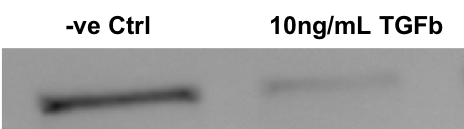 Recombinant Human TGF-beta 2 Protein 302-B2