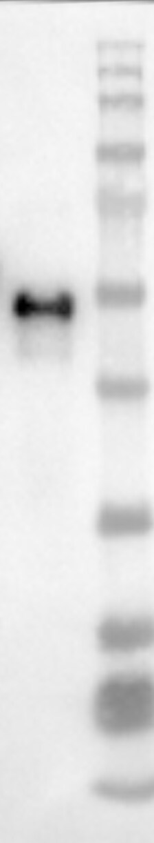 Recombinant Human EphA2 Protein, CF 3035-A2