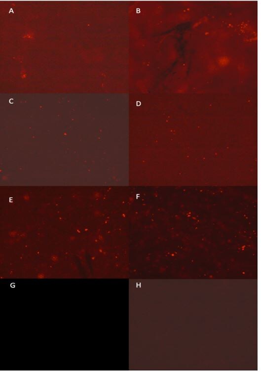 Lightning-Link (R) Rapid Rhodamine Antibody Labeling Kit 311-0010