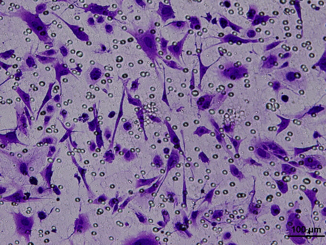 Recombinant Human IL-17A Protein, CF 317-ILB