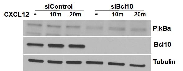 Recombinant Human/Rhesus Macaque/Feline CXCL12/SDF-1 alpha 350-NS