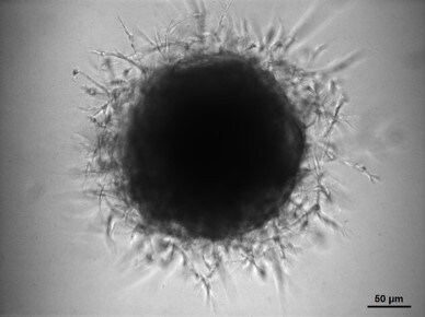 Cultrex 3-D Spheroid Basement Membrane Extract Cell Invasion Assay, 96-well 3500-096-K