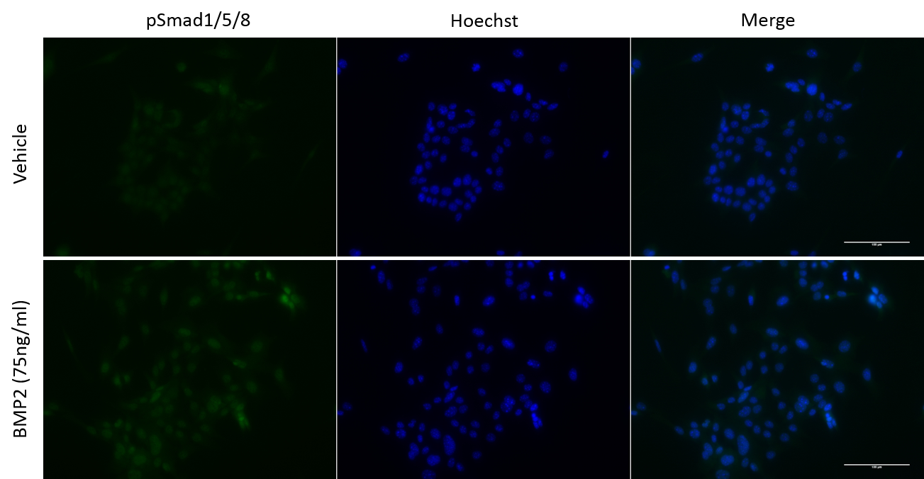 Recombinant Human/Mouse/Rat BMP-2 Protein 355-BM