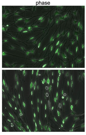 Recombinant Human NRG1-beta 1/HRG1-beta 1 ECD Protein 377-HB