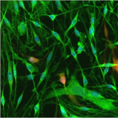 Recombinant Human NRG1-beta 1/HRG1-beta 1 ECD Protein 377-HB