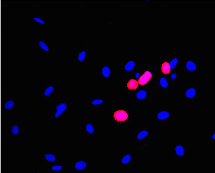 Recombinant Human NRG1-beta 1/HRG1-beta 1 ECD Protein 377-HB