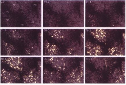 Recombinant Human PDGF R beta Fc Chimera Protein 385-PR