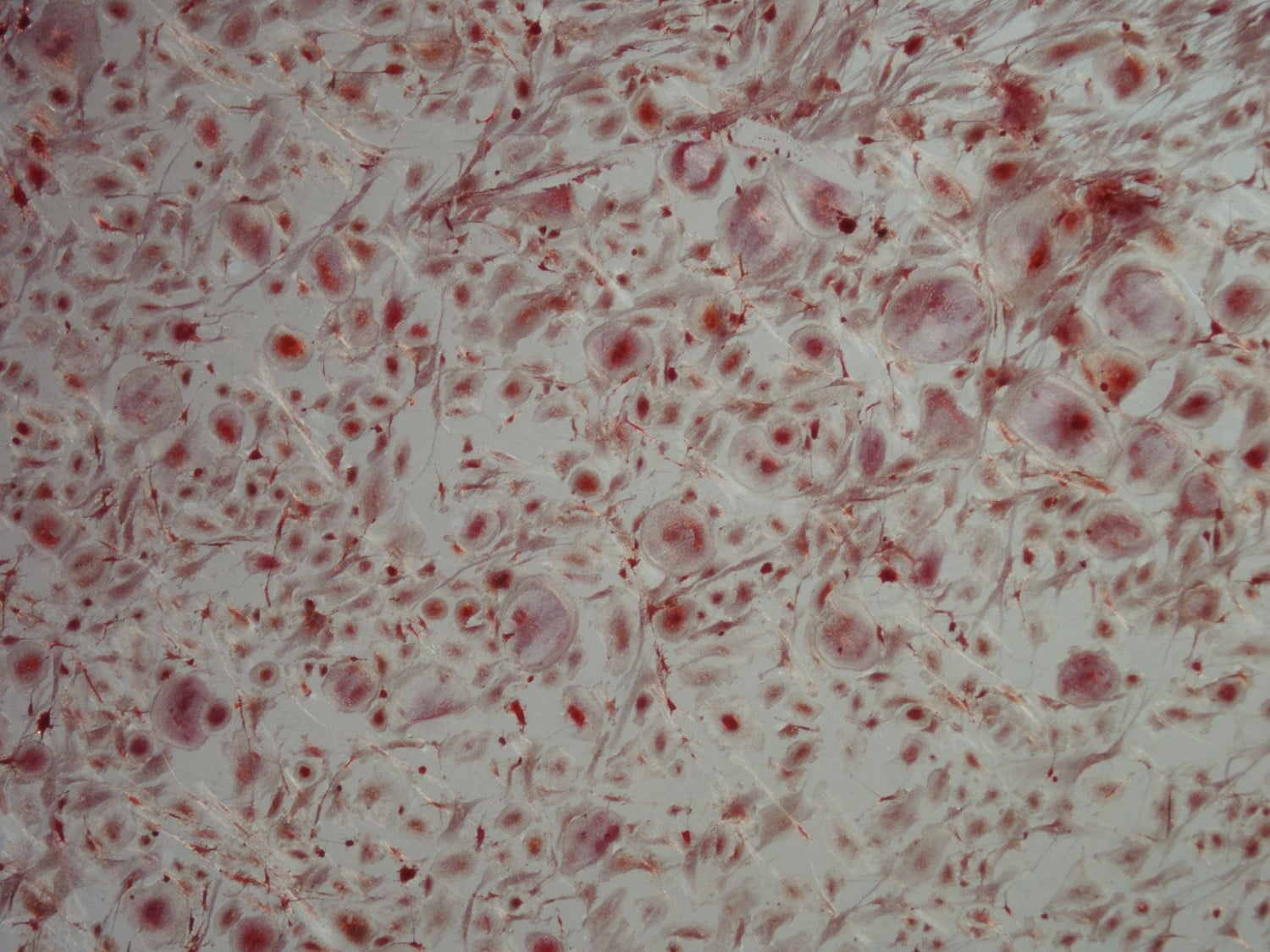Recombinant Human TRANCE/RANK L/TNFSF11 Protein 390-TN